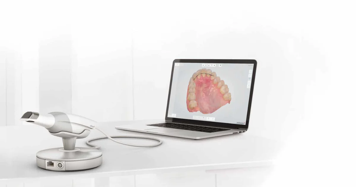 Ilustração do fluxo digital na odontologia, do escaneamento à entrega da peça